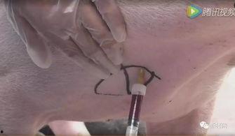 成人静脉采血视频,静脉采血操作步骤及要点解析